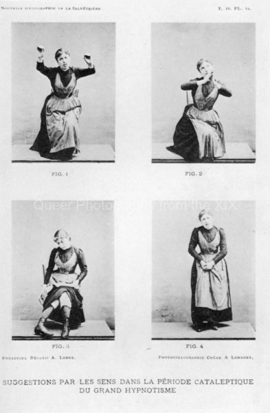 60_Londe-photographic-series-for-an-article-by-Guinon-and-Woltke-in-the-NIS-1891.