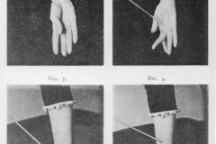 44_Pitres-Effects-of-mechanical-excitation-of-several-of-Marie-Louise-F.-.-.s-hand-muscles-in-the-state-of-catalepsy-Lecons-cliniques-1891.