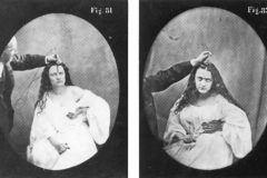 58_Duchenne-de-Boulogne-two-typical-imitations-of-Lady-Macbeth-cruelty-expressions-induced-with-electricity-Mecanismes-de-la-physionomie-humaine-1862